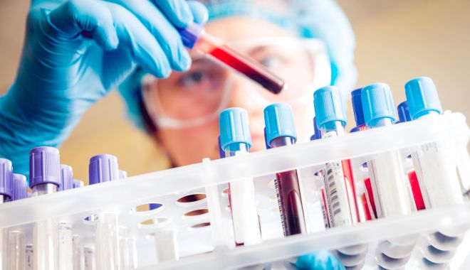 Oamenii de ştiinţă au descoperit o genă care poate creşte riscul de cancer al sângelui
