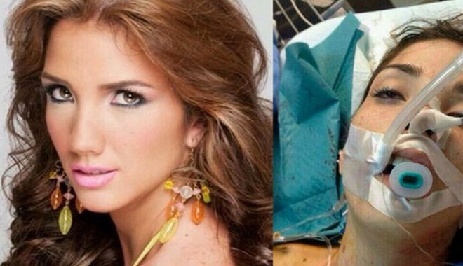 Miss Turism din Venezuela 2013, împușcată mortal în timpul protestelor antiguvernamentale - genesiscarmona3164631-1392901565.jpg