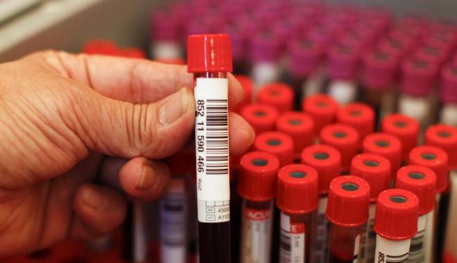 Analiză nouă, pe lista investigațiilor medicale gratuite - hemoleucogramacompleta-1443019208.jpg