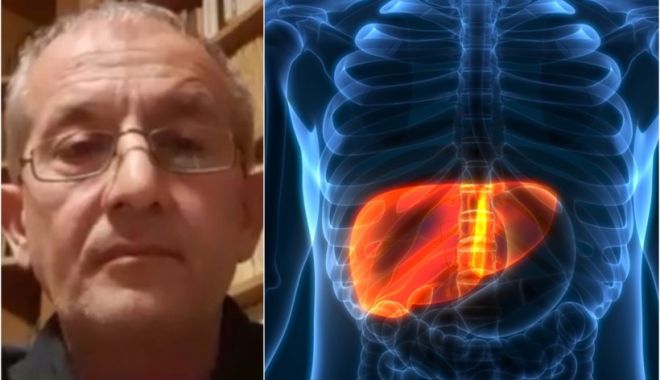 Doctor Cătălin Apostolescu explică diferenţa dintre hepatita misterioasă şi boala Wilson