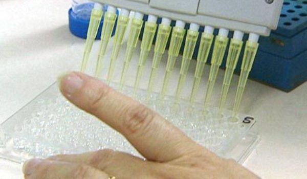 Cum afli dacă ai hepatită - hepatita-1348614688.jpg
