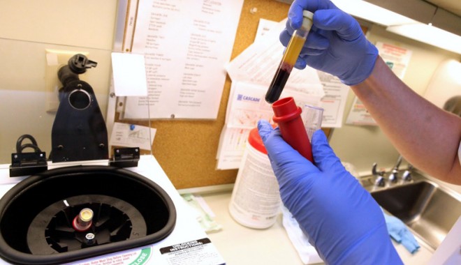 Când se fac teste pentru depistarea hepatitei C - hepatitac-1353691457.jpg