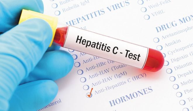 Aproximativ 89.000 de locuitori din zona Dobrogei s-au testat pentru infecțiile cu HIV sau hepatite virale - hepatitac-1627225307.jpg