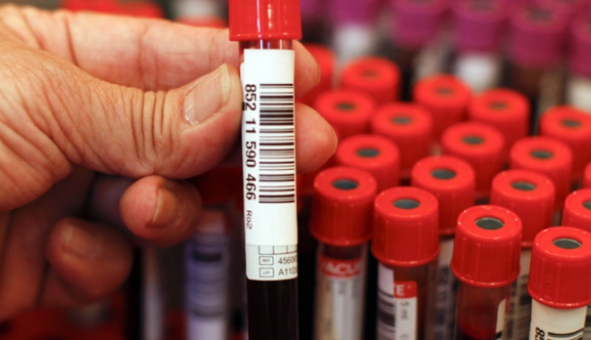 Hepatita poate fi tratată. Diagnosticare gratuită, la Medstar General Hospital - hepatitmedstar-1476111219.jpg