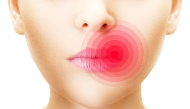 SUFERI DE HERPES? ÎN SFÂRȘIT, UN REMEDIU EFICIENT - herpesdraristide-1467200309.jpg