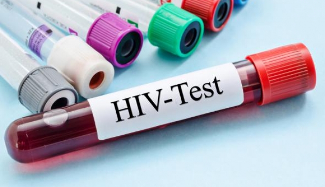 Virusul SIDA a dispărut ca prin minune la o fetiță de nouă ani - hiv-1500911226.jpg