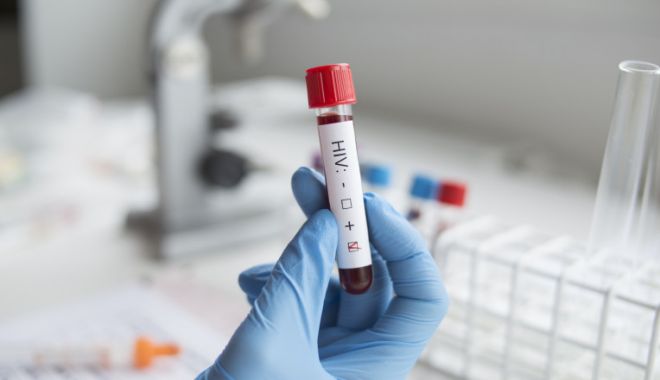 A fost descoperit al doilea pacient care s-a vindecat de HIV fără tratament - hiv-1637072447.jpg