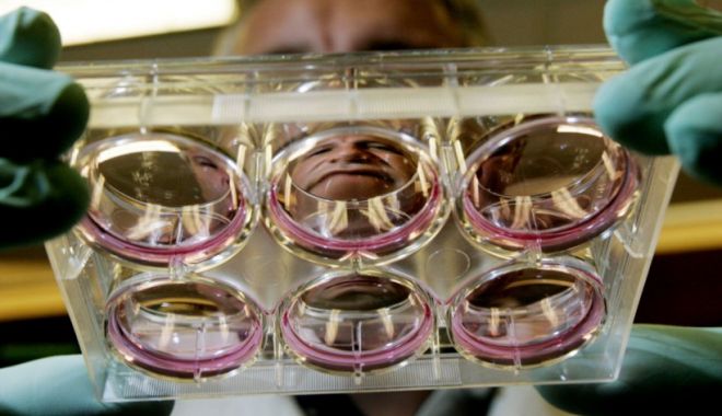 Bărbat vindecat de HIV după un transplant de măduvă osoasă - hiv-1659027444.jpg