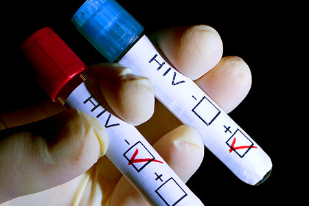 Mai multe fonduri pentru bolnavii cu HIV - hiv5-1392714515.jpg