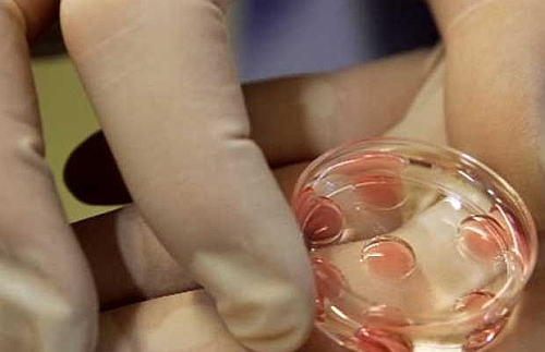 Fertilizare in vitro pentru 330 de cupluri - in20vitro-1315219757.jpg