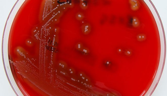 INSP: Infecţiile respiratorii în săptămâna 18 - 24 martie, trend crescător