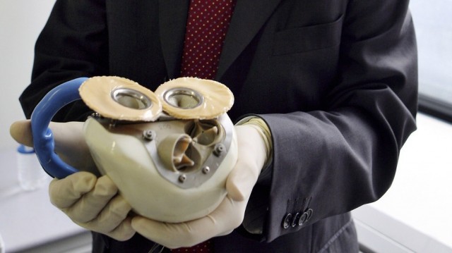 Implantul de inimă artificială, posibil și în România - inimaartificiala640x359-1418221783.jpg
