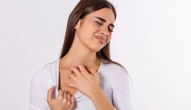 Înțepăturile pielii pot fi un simptom al șocului anafilactic - intepaturijpg-2-1709557405.jpg