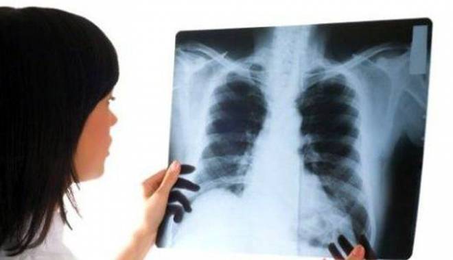 Investigații gratuite pentru depistarea cancerului pulmonar - investigartiicancermedstar-1430051645.jpg