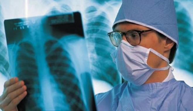 Investigații gratuite pentru diagnosticarea cancerului pulmonar - investigatiigratuitecancerpulmon-1422552965.jpg