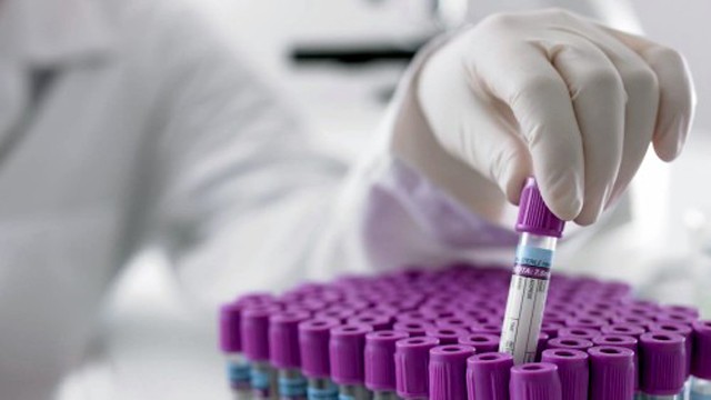 Aproape jumătate din populație suferă de anemie! Iată unde - laboratoranalize640x360-1438678767.jpg