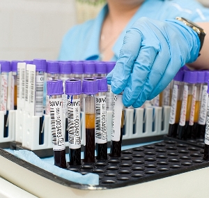 Substanță letală vândută pe internet. O picătură e suficientă pentru a ucide un om - laboratorapamoleculah2o-1539802408.jpg