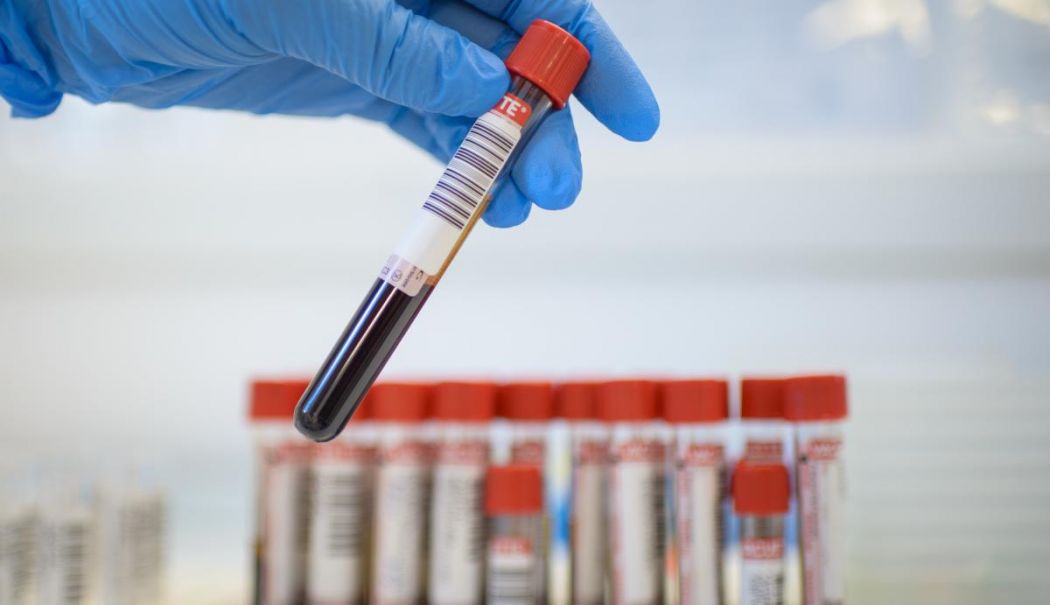 Suspiciunea de focar cu Norovirus de la Liceul ''C.D. Loga'', confirmată