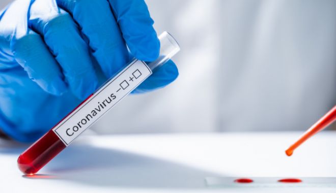 Coronavirus la Constanța. 1.082 de persoane au fost confirmate cu COVID-19 până la ora actuală - laboratoryassistanttestsbloodnew-1596732304.jpg