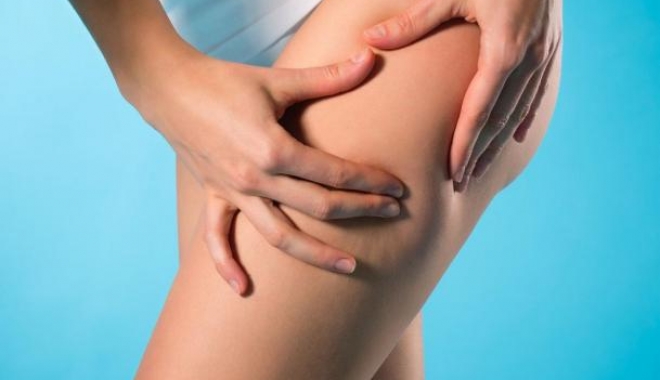 Cum se tratează lipoamele, rapid și fără durere - lipom-1494485284.jpg