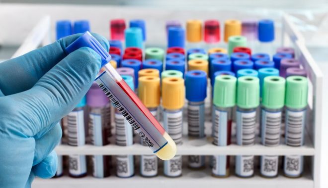 Lista cu medicamente compensate și gratuite, extinsă - listacumedicamente-1528186377.jpg