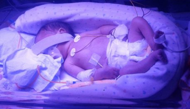 CAZ ȘOCANT. Un bebeluș s-a născut la 3 luni după moartea mamei sale. GALERIE FOTO - lourencosalvadorfaria81247100-1465834056.jpg