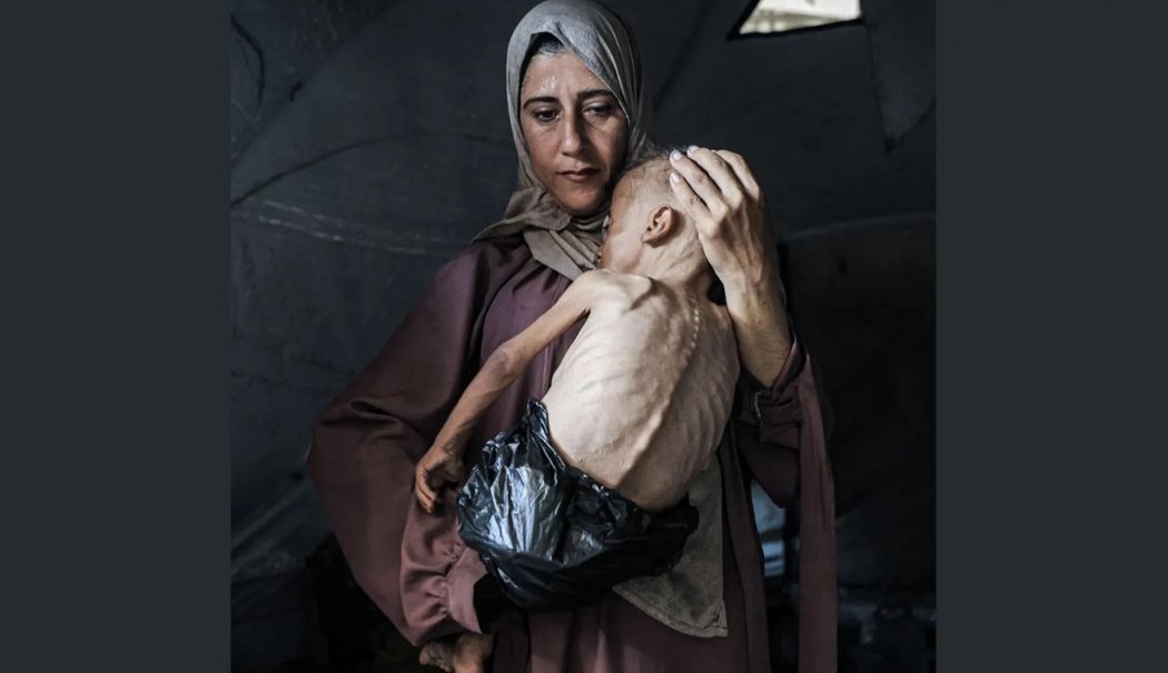 Unul din cinci copii din oraşul Gaza suferă de malnutriţie - malnutritie-1753459464.jpg