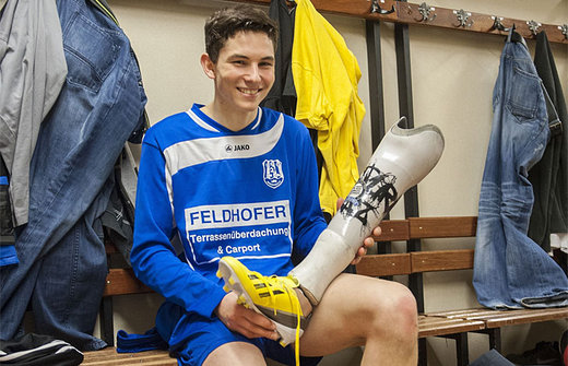 Caz fără precedent în fotbal: FIFA a autorizat un jucător austriac cu piciorul amputat să joace cu o proteză - martinhofbauer-1368372720.jpg