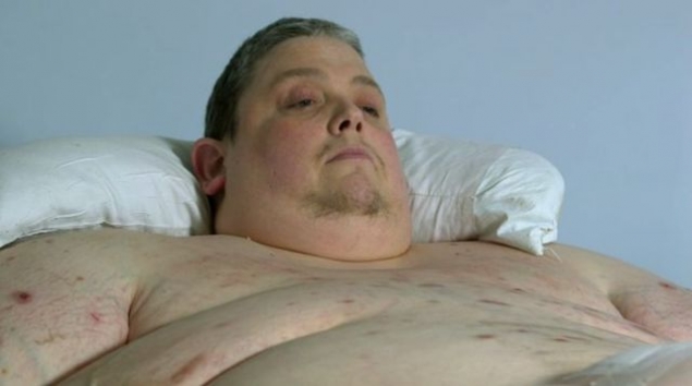 RADIOGRAFIA unui om de 450 DE KILOGRAME! Iata CE ASCUND corpurile oamenilor OBEZI - media140376973630442700-1403780716.jpg