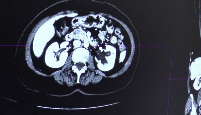 Tinerii care revoluţionează sistemul medical din România. Ce au creat aceștia