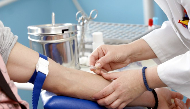 De ce crește colesterolul la tineri - medicdececrestecolest-1394638373.jpg