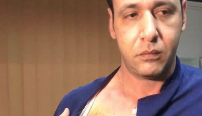 Medic bătut crunt în spital. Agresorul de 26 de ani a fost reținut - mediculbatut801027599600-1519113950.jpg