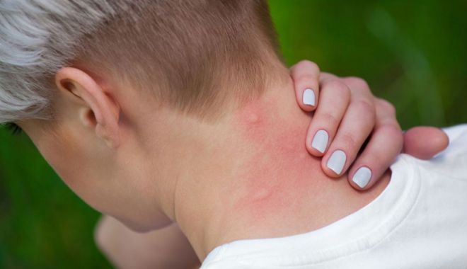 Feriți-vă de țânțari! Virusul West Nile a făcut prima victimă la Constanța - meningoencefalite3-1534955469.jpg