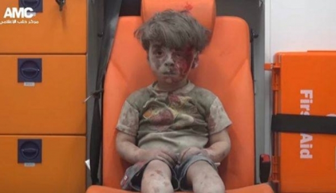 Îl mai țineți minte pe băiețelul care a devenit simbolul războiului din Siria? Noi fotografii cu el au apărut pe Internet - mic53112900-1496747685.jpg