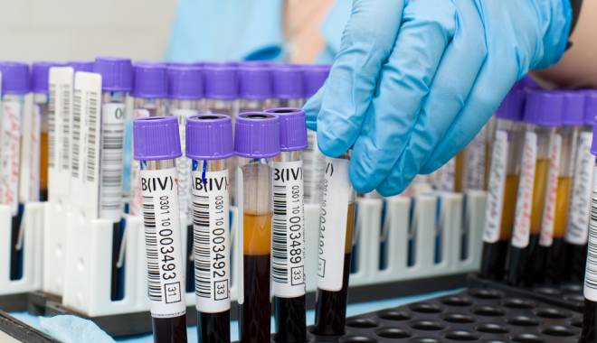 Ce înseamnă diagnosticul microbiologic - microbiologie-1432916160.jpg