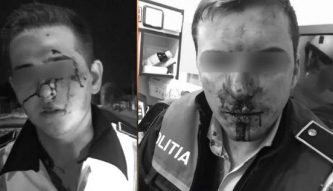 Unul dintre polițiștii bătuți de rudele unui suspect, transferat la un spital din București - mmywnta4mzu5odllnzdmnzbmytnkndey-1574330773.jpg