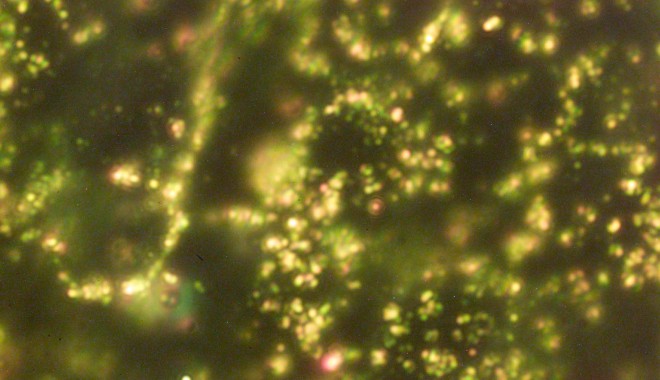 Nanoparticulele din aur - tratament împotriva cancerului de prostată - nanoparticule-1342964680.jpg