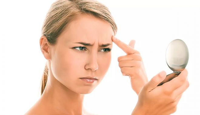 Negii nu creează doar neplăceri de natură estetică, ei cauzează și disconfort - negi1-1648559907.jpg