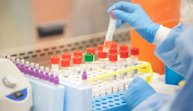 Noi reguli la testarea pentru detectarea noului coronavirus. Cine va putea face testul - noiregulitestare1-1585333793.jpg