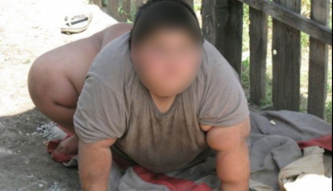 Copilul obez din Dolj a murit miercuri dimineața - obez-1375258239.jpg