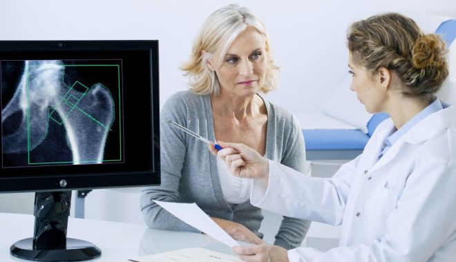 Ce alimente pot preveni instalarea precoce a osteoporozei - osteoporoza-1624795996.jpg