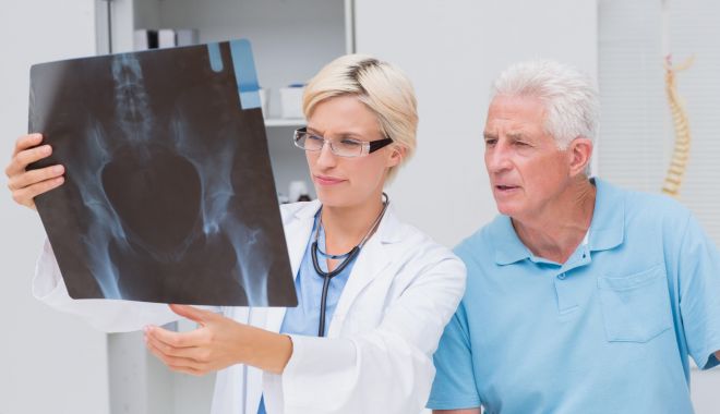 Fructele de mare, recomandate persoanelor cu osteoporoză - osteoporoza1-1654266023.jpg
