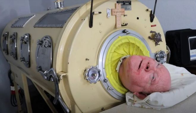 Paul Alexander, bărbatul care a trăit mai bine de 70 de ani într-un „plămân de fier”, a murit la vârsta de 78 de ani