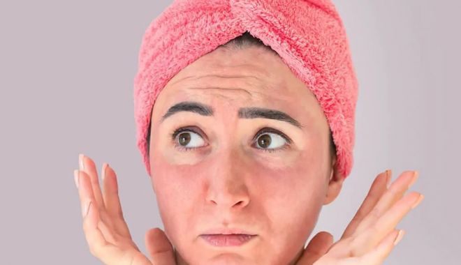 Peeling natural pentru puncte negre și acnee - peeling-1666527584.jpg