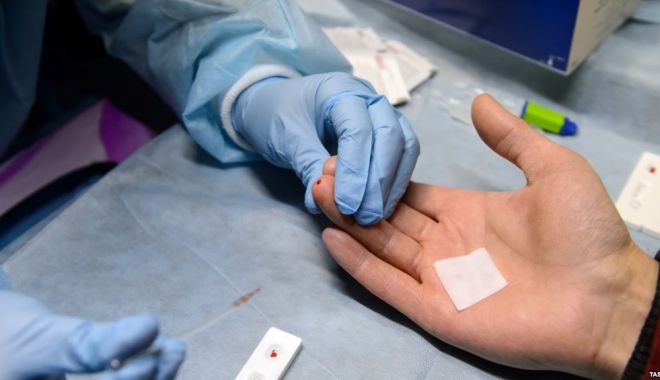 Plan național pentru supravegherea, controlul și prevenirea infecțiilor HIV/SIDA - plannational-1543220741.jpg