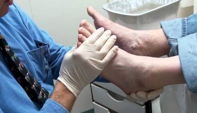 Podiatria, o nouă specializare medicală - podiatria-1432919077.jpg