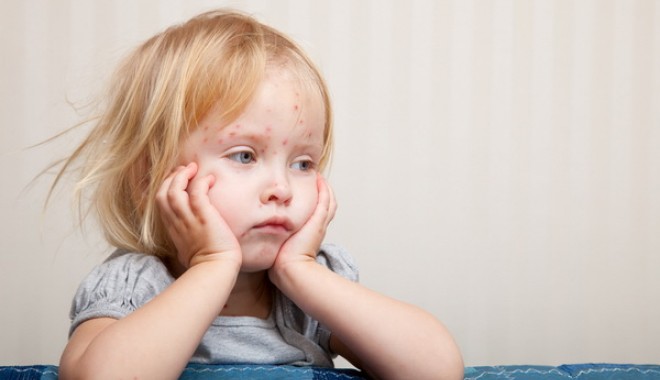 Părinții nu își vaccinează copiii de frică să nu facă autism - pojar-1369129881.jpg