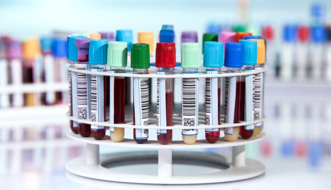 Ce a transmis laboratorul de control doping Bucureşti, în cazul Simona Halep - probe-de-sange-simona-halep-1709909024.jpg