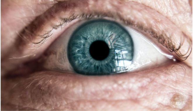 Primul om din lume care a primit o proteză de ochi imprimată 3D este din Marea Britanie - proteza-1637860809.jpg