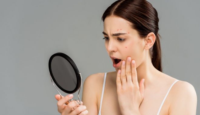 Remedii naturiste pentru ameliorarea psoriazisului - psoriazis-1688310110.jpg